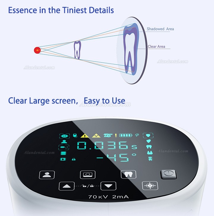 Woodpecker Mini Ray Portable Dental X ray Machine Handheld Unit Intraoral Imaging Xray System